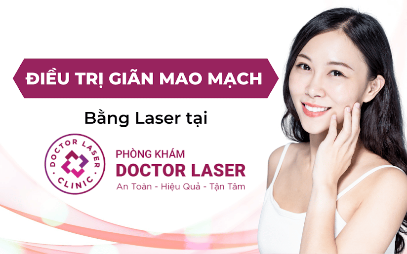 Trị giãn mao mạch bằng laser tại Doctor Laser 